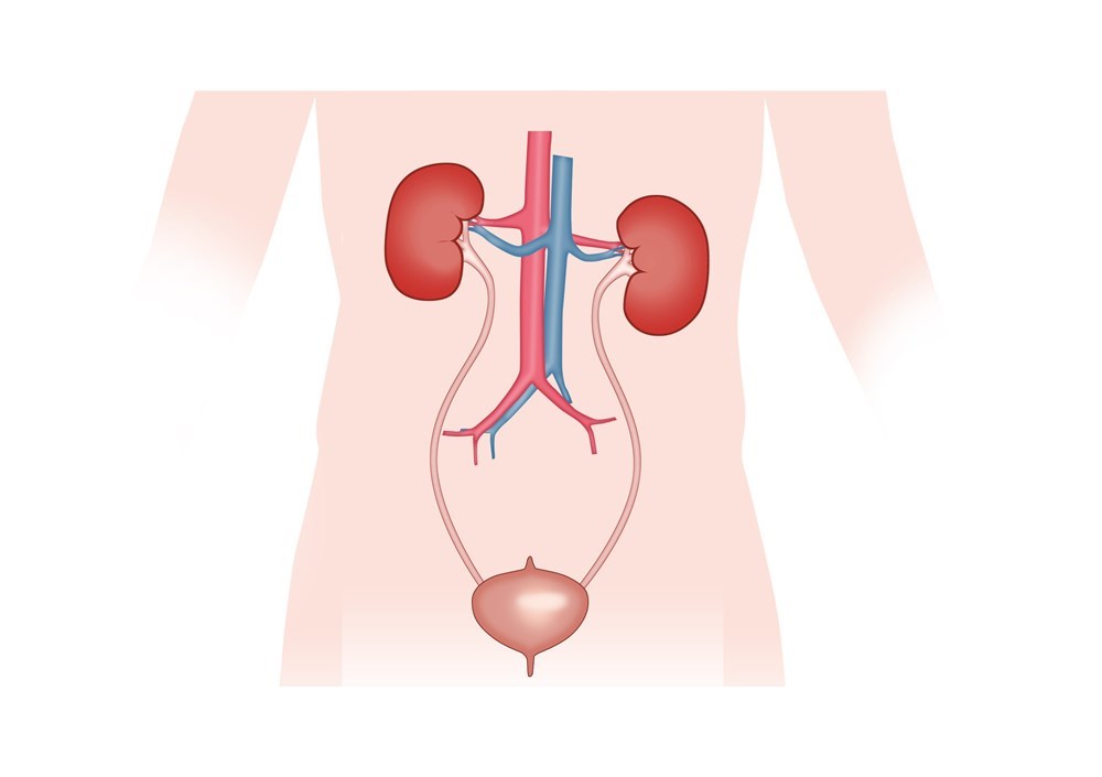 Zivot S Urostomiou (1)